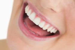 Restore Your Confidence with Dental Implants