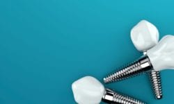 affordable dental implants in pinehurst, north carolina